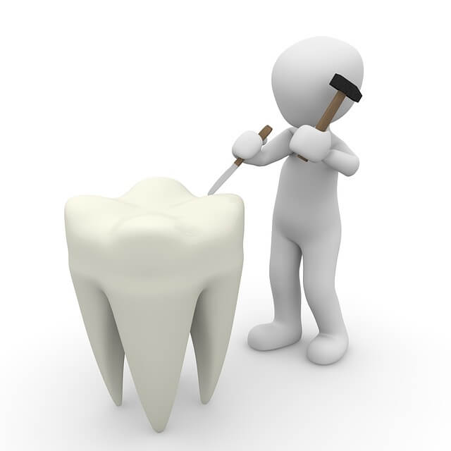 مدة التعافي بعد عملية خلع الاسنان