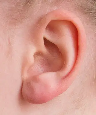 معلومات عن الأذن